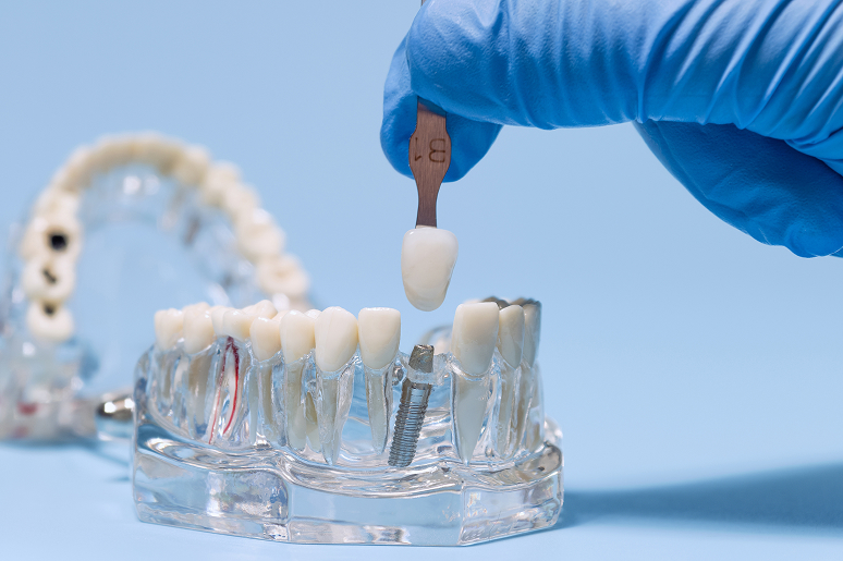 Patient at Caputo Oral Restoration